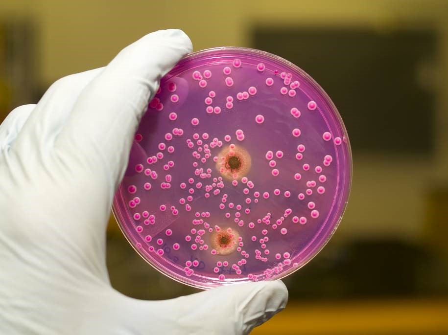 Otthoni tudnivalók az élelmiszer-biztonságról - Baktériumok és vírusok